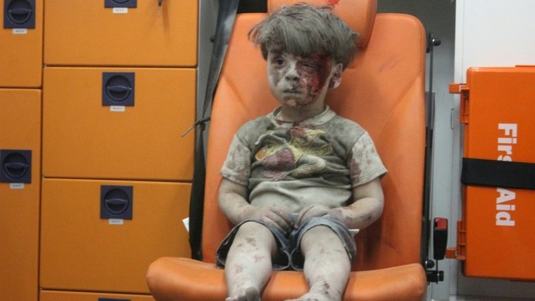 Omran é uma das milhares de crianças vítimas da guerra na Síria