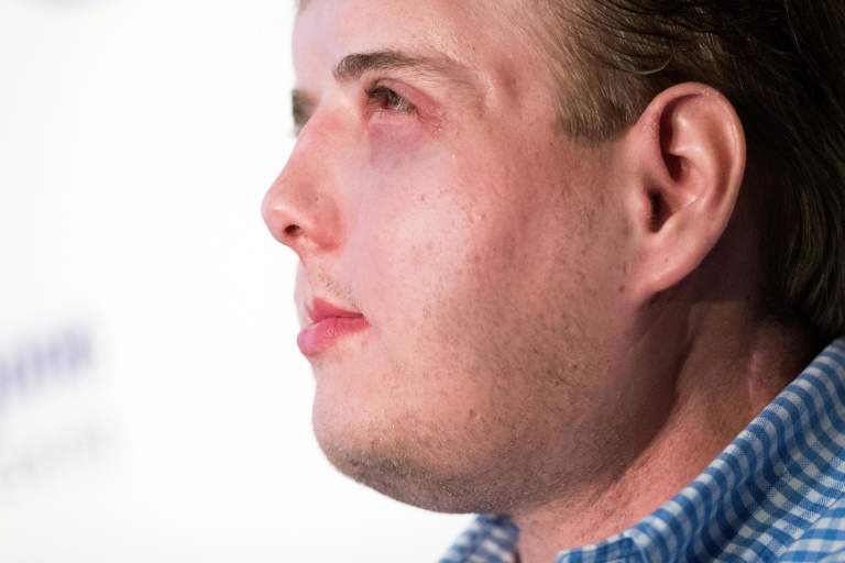 Bombeiro americano se sente 'normal' um ano após transplante de face