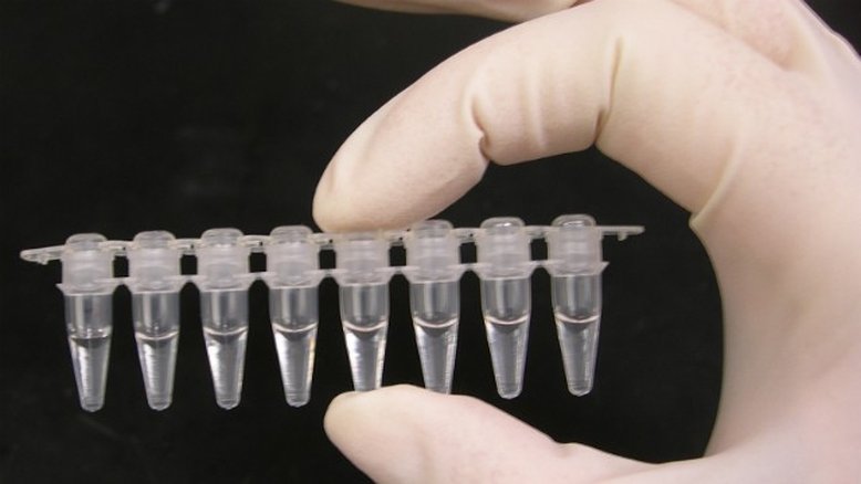 Exame portátil e barato pode detectar o vírus Chikungunya em 15 minutos
