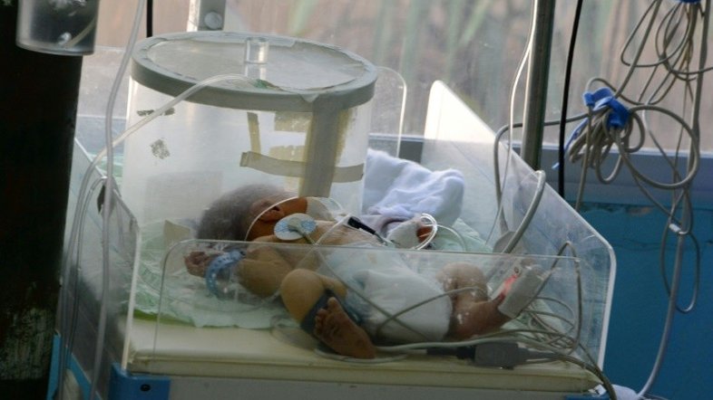 Mortalidade infantil no País é três vezes maior entre bebês com microcefalia