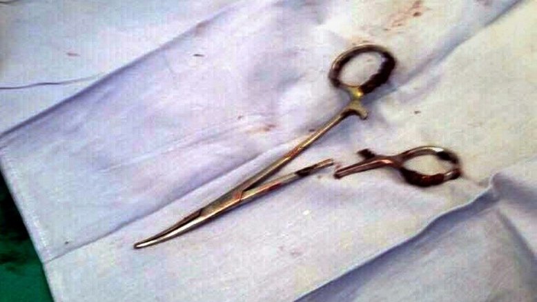 Vietnamita é operado para retirar tesouras esquecidas em cirurgia há 18 anos
