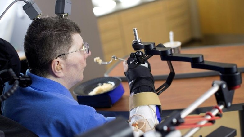 Tetraplégico recupera uso do braço em caso inédito na medicina (estudo)
