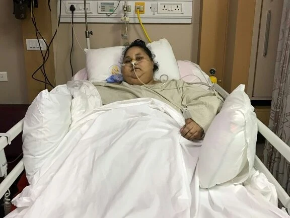 Mulher mais obesa do mundo perde 100 kg após cirurgia