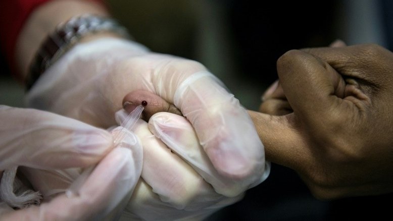 Doenças sexualmente transmissíveis atingem nível recorde nos EUA