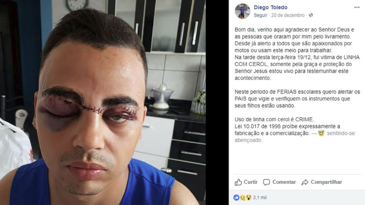 Jovem tem rosto cortado por cerol e expõe risco em rede social em Itupeva