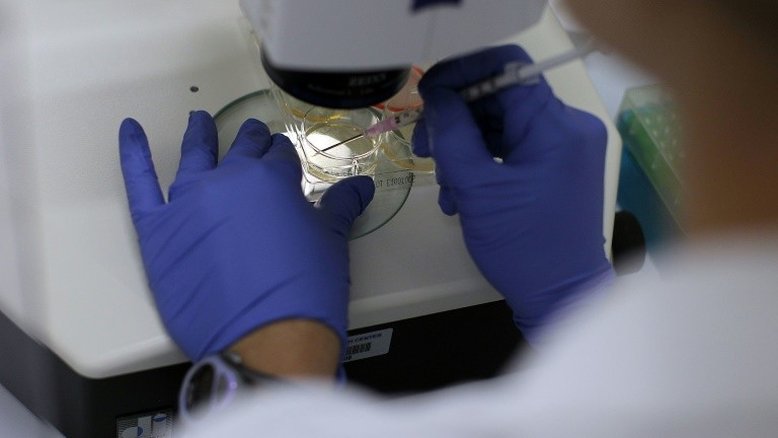 Transplante de células-tronco dá esperança a pacientes com esclerodermia