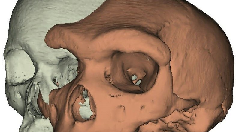 Como erguer as sobrancelhas ajudou a evolução humana