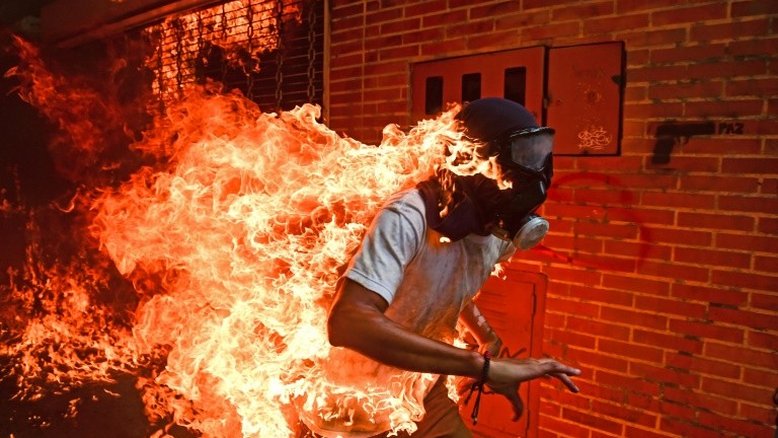 Imagem de jovem em chamas leva prêmio de melhor foto do ano
