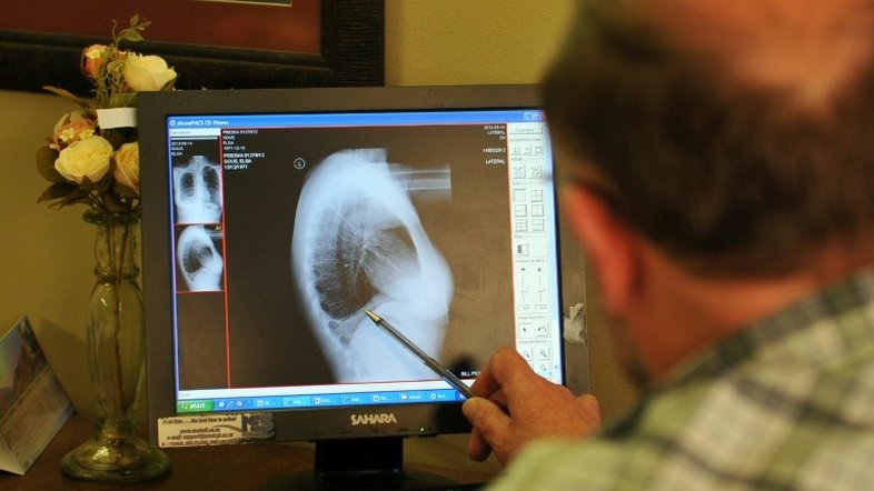 Acordo histórico na África do Sul para indenizar trabalhadores com silicose