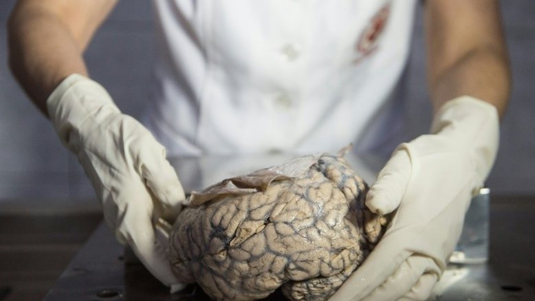 Cientistas tentam explicar como - e porque - cérebro humano cresceu tanto