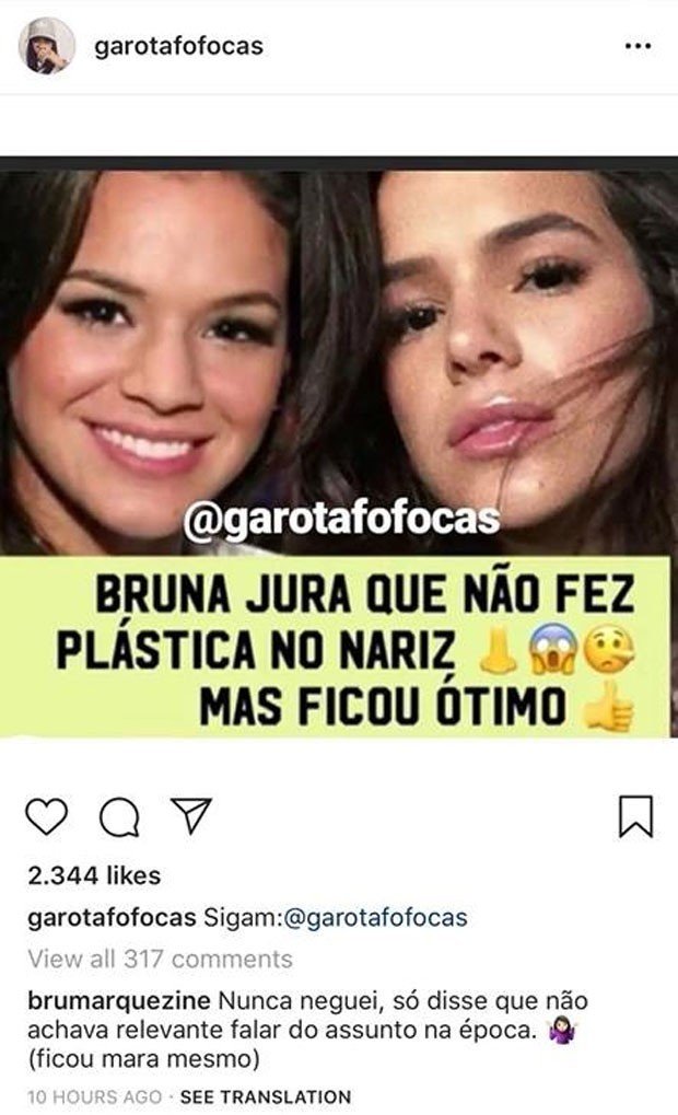 Bruna Marquezine assume já ter feito plástica no nariz: "Ficou mara" 2 Bruna Marquezine assume já ter feito plástica no nariz: "Ficou mara"