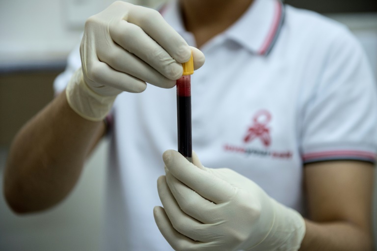 Quantos anos têm seus órgãos vitais? Um simples exame de sangue pode salvar sua vida