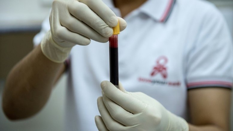 Quantos anos têm seus órgãos vitais? Um simples exame de sangue pode salvar sua vida