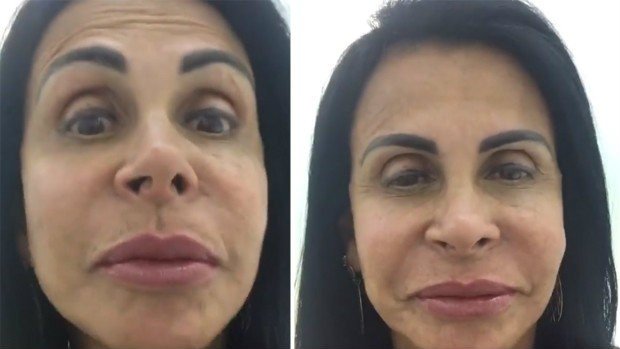 Gretchen volta ao Brasil e mostra resultado de tratamento estético na boca 4 Gretchen volta ao Brasil e mostra resultado de tratamento estético na boca