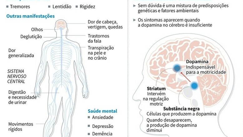 Pesquisadores transplantam células-tronco para cérebro para tratar Parkinson