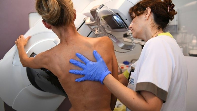 Exame de sangue pode ajudar a escolher tratamento para câncer de mama