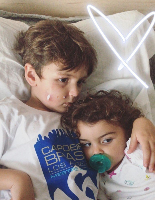 Filho de Felipe Simas leva mordida de cachorro no rosto 4 Filho de Felipe Simas leva mordida de cachorro no rosto