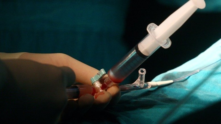 Japão faz teste clínico de trasplante com células iPS na coluna dorsal