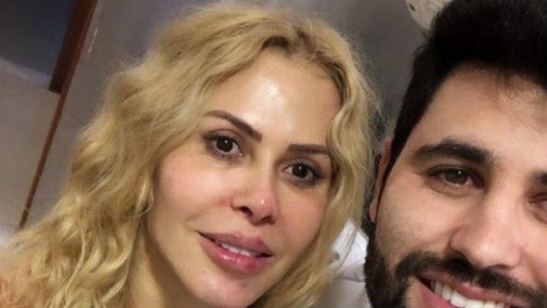 Joelma realiza harmonização facial com mesmo médico de Gretchen