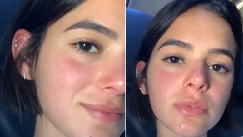 Bruna Marquezine surpreende fãs ao mostrar alergia durante voo