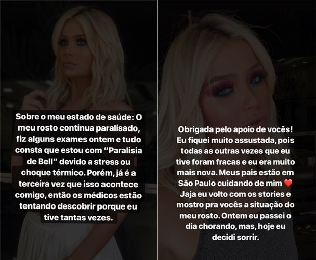 Youtuber Dainara Pariz está com metade do rosto paralisado 8 Youtuber Dainara Pariz está com metade do rosto paralisado