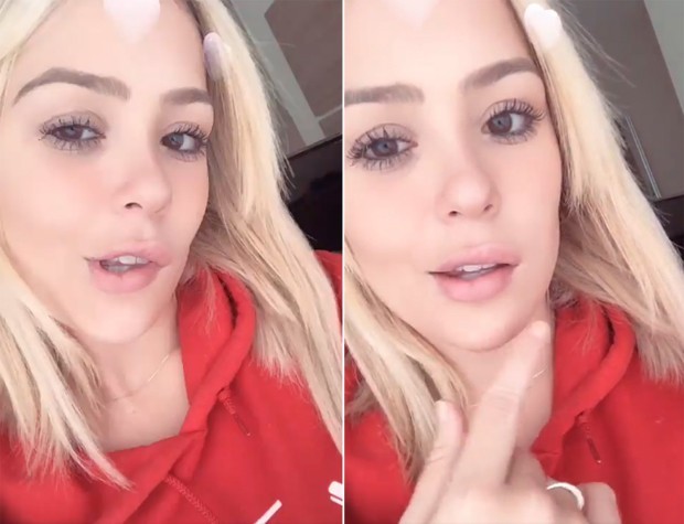 Youtuber Dainara Pariz está com metade do rosto paralisado 7 Youtuber Dainara Pariz está com metade do rosto paralisado