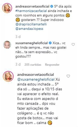 Xuxa diz que não gostou da harmonização facial de Sorvetão 4 Xuxa diz que não gostou da harmonização facial de Sorvetão
