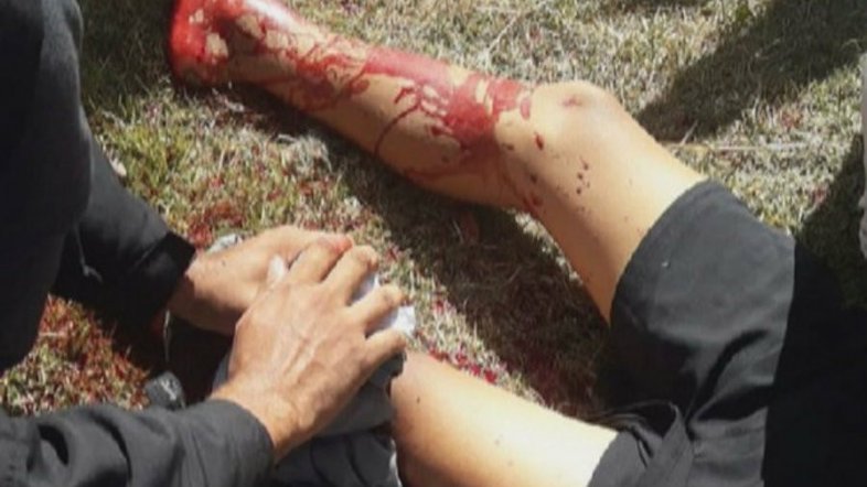 Reprodução/Redes Sociais