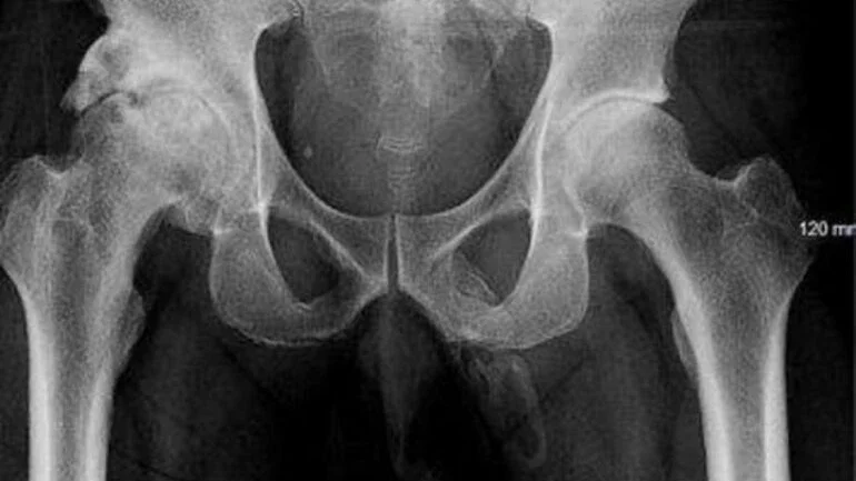 Divulgação/Urology Case Reports