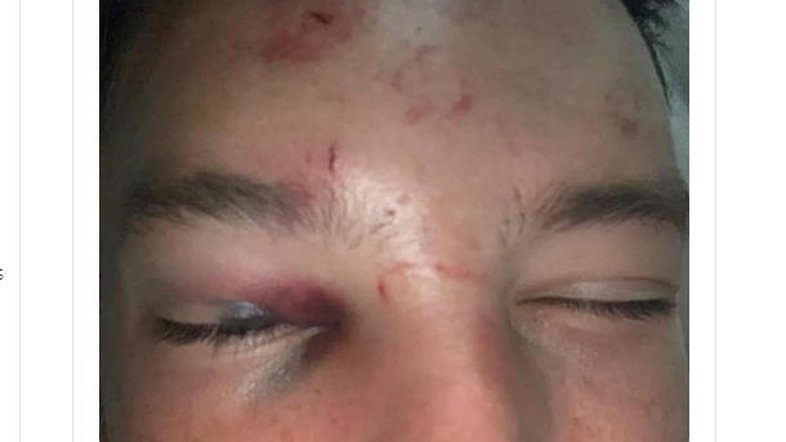 Meia da seleção inglesa é espancado após tentar sair com esposa de outro jogador