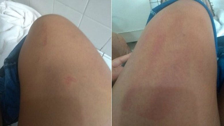 Reprodução