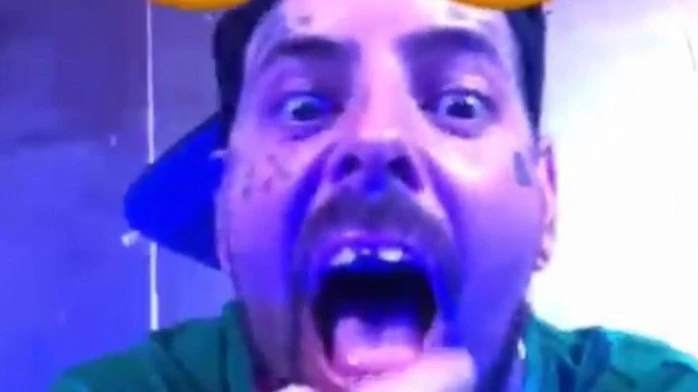Tico Santa Cruz quebra o dente com o microfone: 