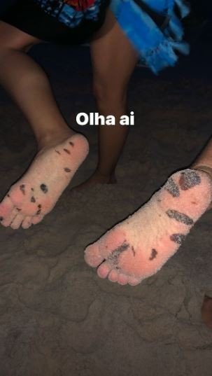 Em Alagoas, Whindersson Nunes exibe manchas de óleo nos pés 4 Em Alagoas, Whindersson Nunes exibe manchas de óleo nos pés