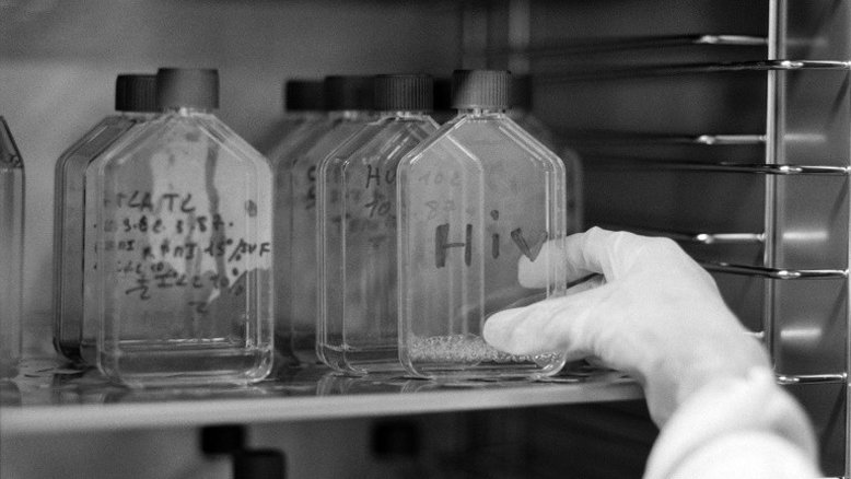 Laboratório americano identifica novo subtipo de HIV