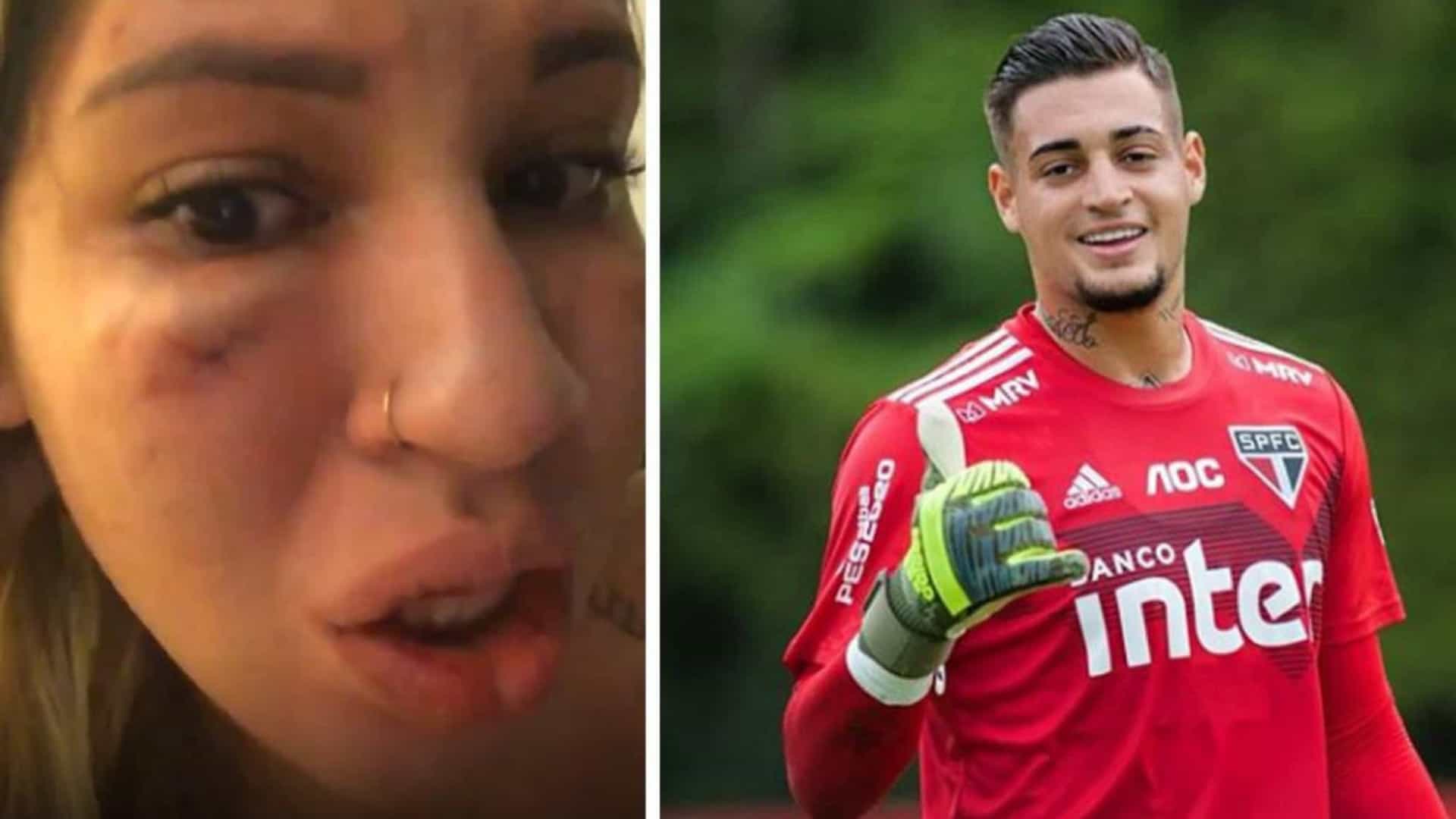 Mulher do goleiro Jean, do São Paulo, acusa o marido de agressão
