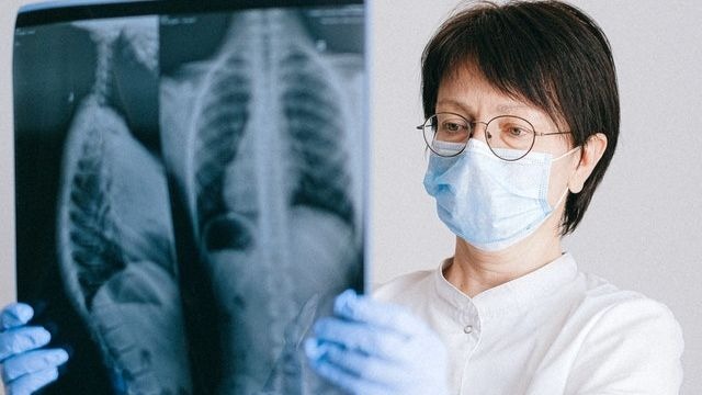Sinal oculto do câncer de pulmão pode ser revelado pelos dedos
