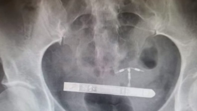 Reprodução YouTube