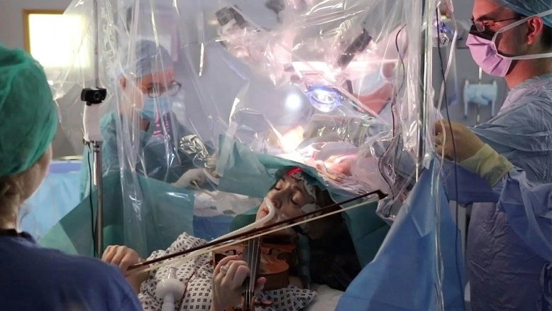 Mulher toca violino para salvar as mãos durante cirurgia no cérebro