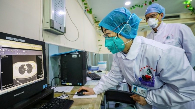 Medicamentos contra aids podem servir para coronavírus