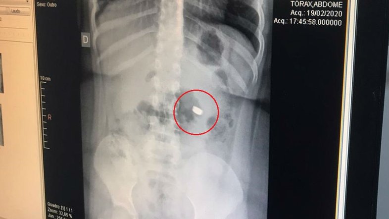 Reprodução/ Arquivo pessoal