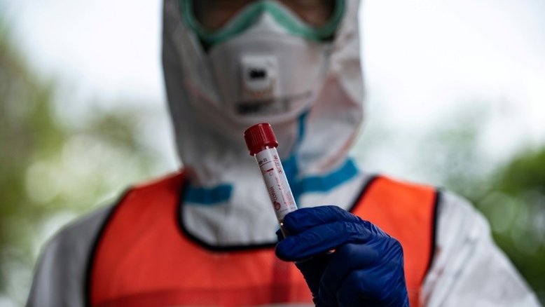 Estudo indica que imunidade à Covid-19 pode ser maior do que apontam testes