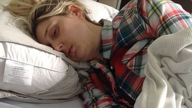 Danos nos nervos faz mulher ficar paralisada toda vez que mexe a cabeça
