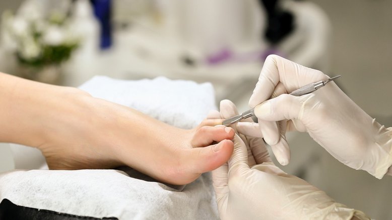 Mulher fica com pé roxo após pegar infecção em pedicure