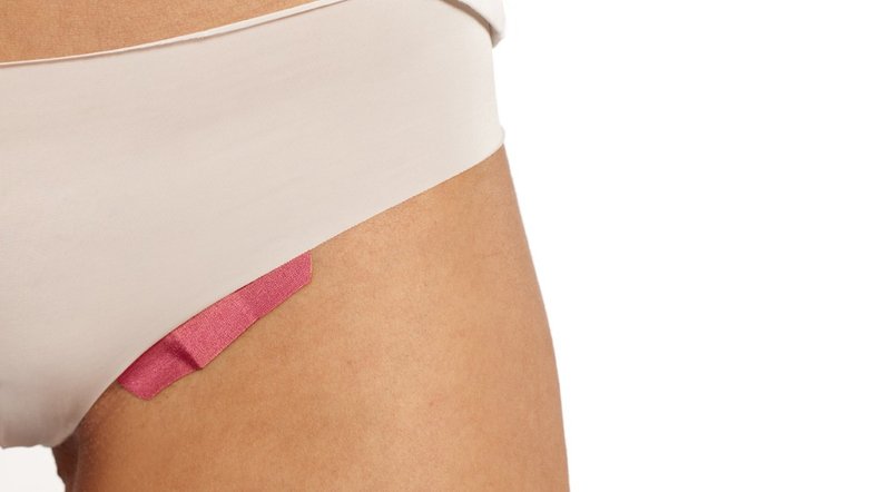 Mulher tira espinha da virilha e descobre que, na verdade, era uma larva