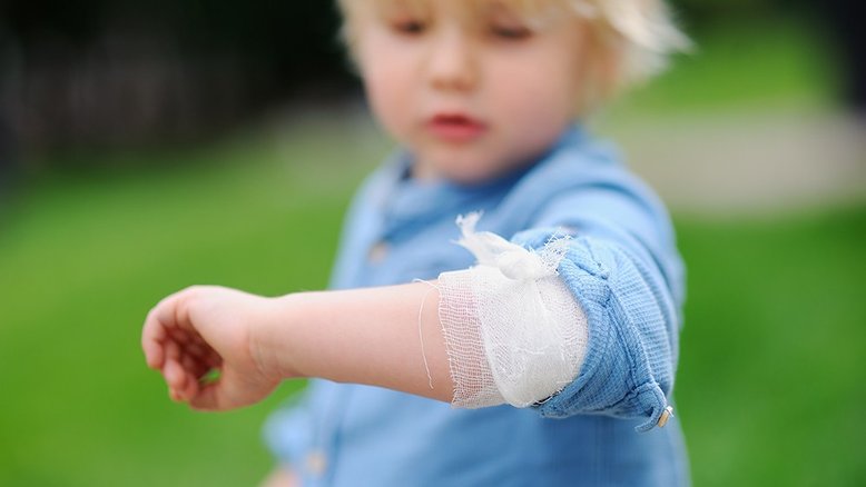 Mãe salva vida do filho após notar pequeno machucado no braço dele