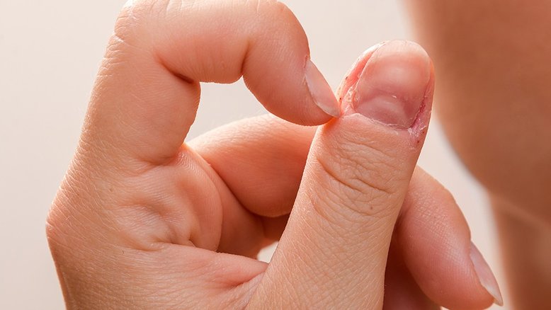 Eca! Morder as unhas pode causar infecção por fungos