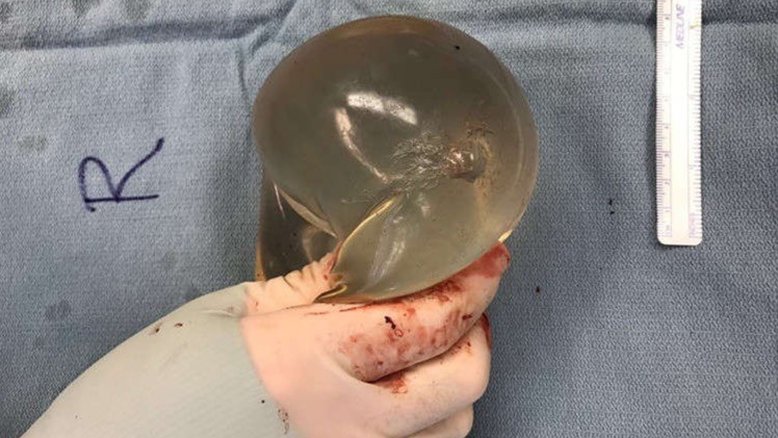 Plastic Surgery Case Studies