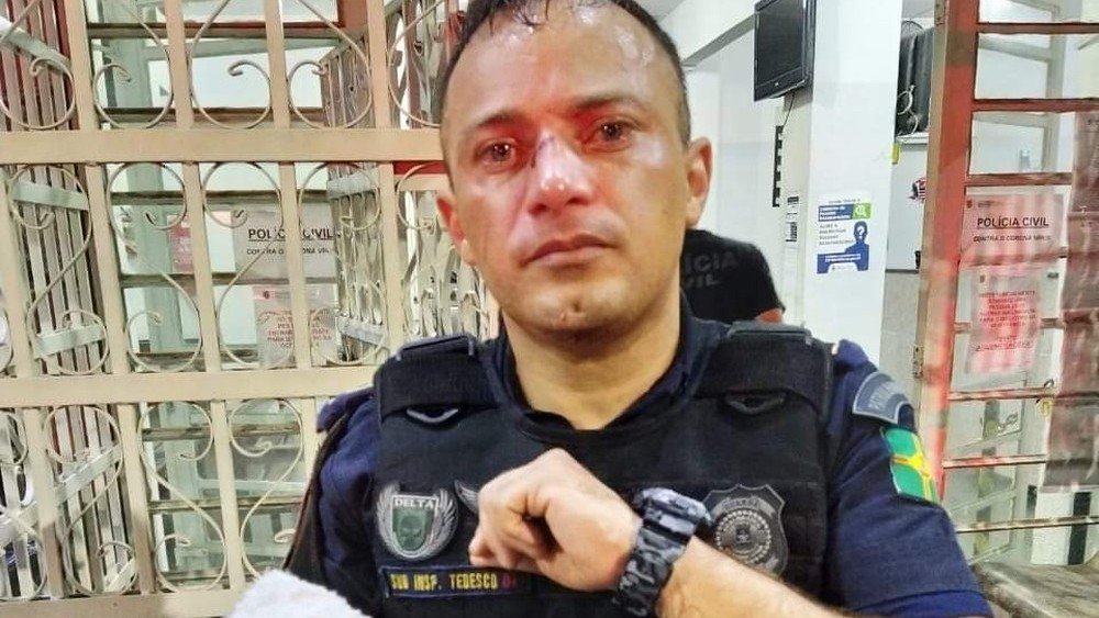SP: Homem é ferido com tiro de bala de borracha por GCM ao desrespeitar quarentena