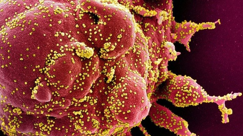 National Institute of Allergy and Infectious Diseases/AFP/Arquivos