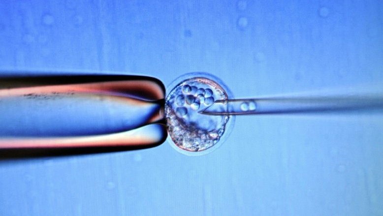 Tratamento pioneiro no Japão com células-tronco em bebê com doença hepática